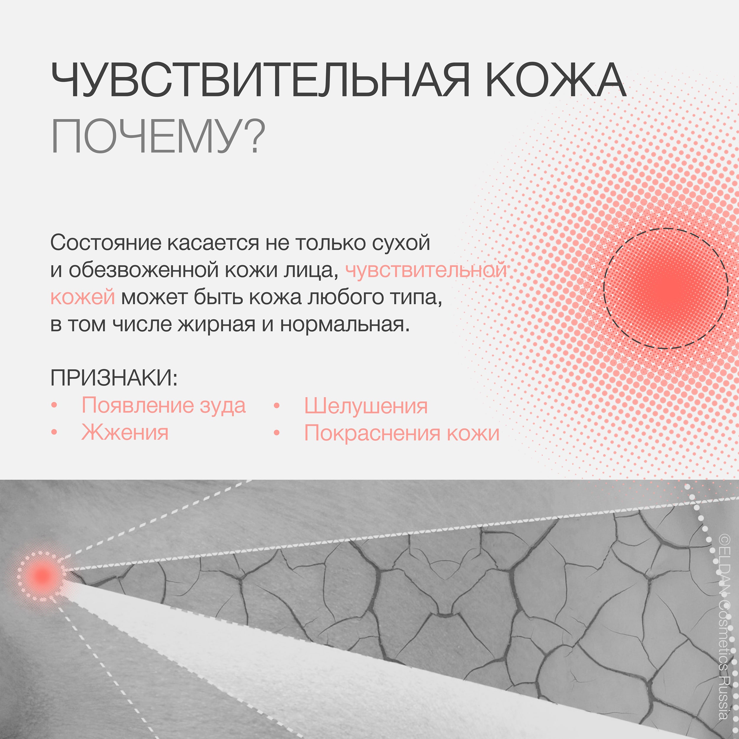 Пост чувствит кожа причины 2.jpg Пост чувствит кожа причины 2.jpg